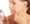 CGF Facial Rejuvenation at DentEssential Richmond