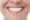 DentEssential Teeth Whitening Richmond