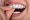 The Benefits of Invisalign dentessential