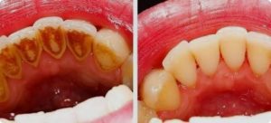 Oral health and overall health