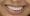 Best Dental Services | Dentessential